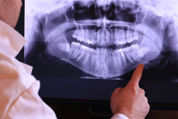 Best Same-Day Emergency Dental Services in Cobb Island, MD