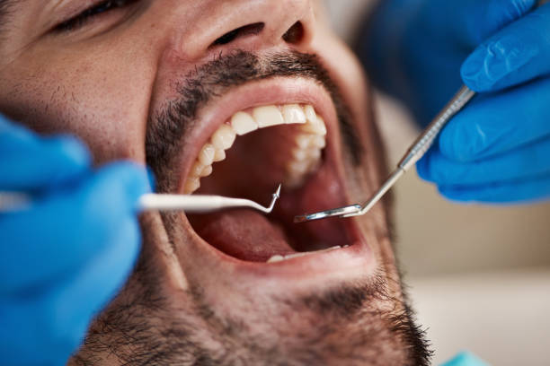 Best Emergency Gum Treatment in Cobb Island, MD