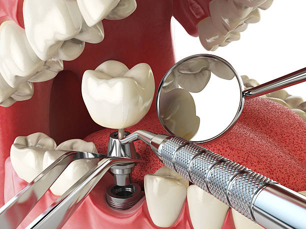 Best Weekend Emergency Dentist in Cobb Island, MD